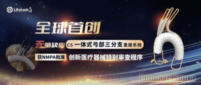 第17個創新綠色通道！先健CS一體式弓部三分支重建系統進入創新醫療器械特別審查程序